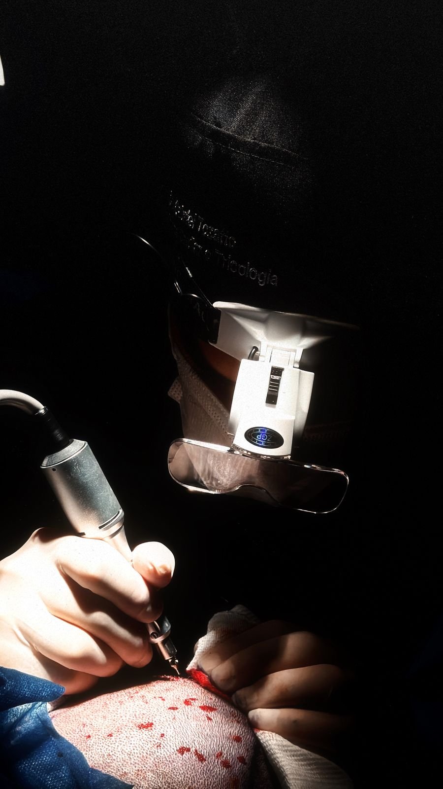 Implante com iluminação frontal